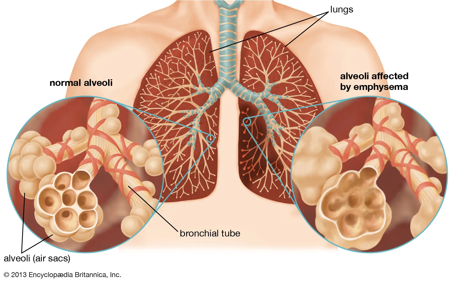 Respiratory Diseases