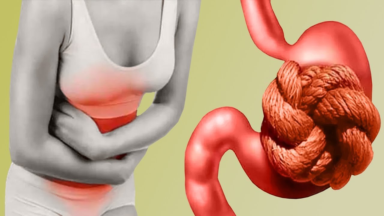 Digestion